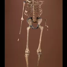 骨骼图像，正面视图，重量15000