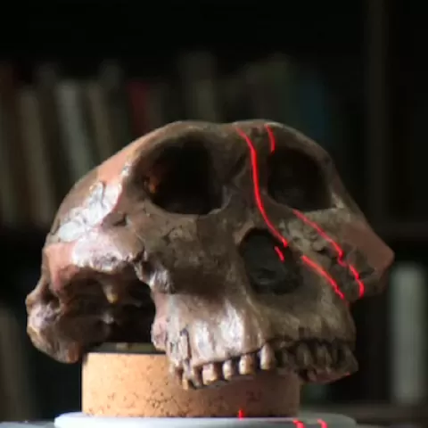 视频缩略图的头骨被成像的新技术老化石”